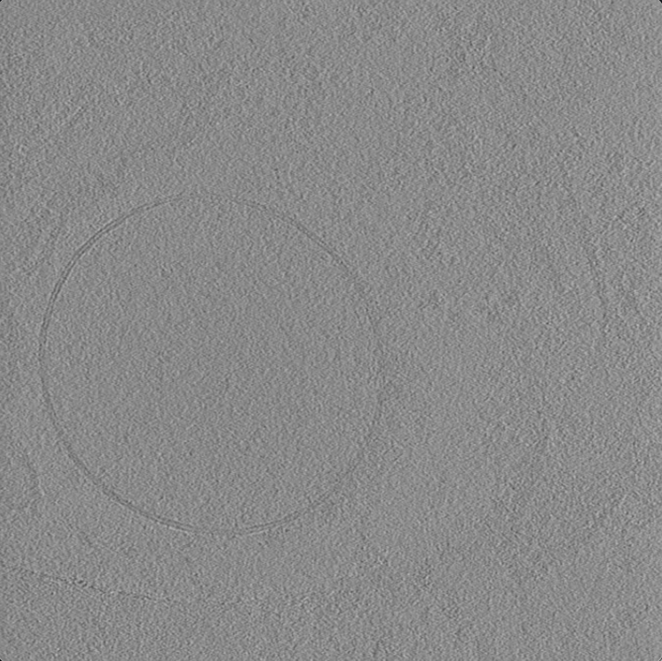 Movie clips of raw tilt series, tilt series after alignment, and tomogram of a purified lysosome.