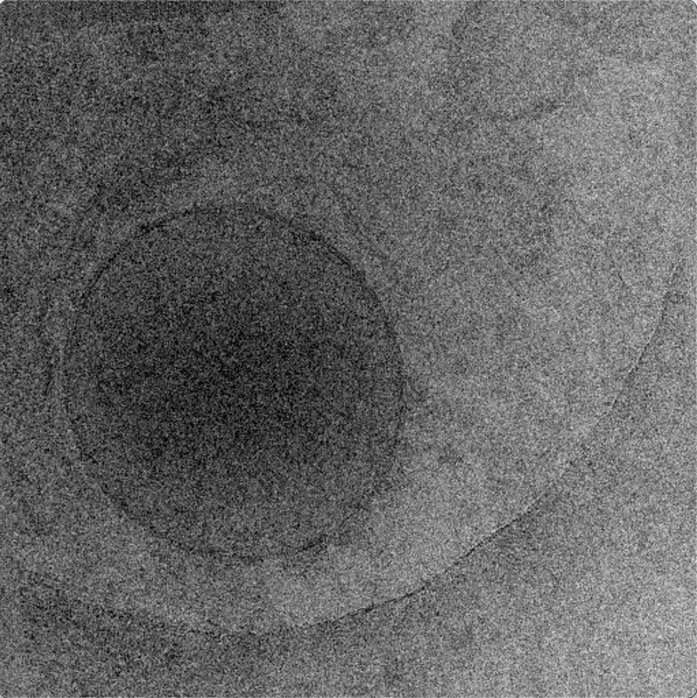 Movie clips of raw tilt series, tilt series after alignment, and tomogram of a purified lysosome.