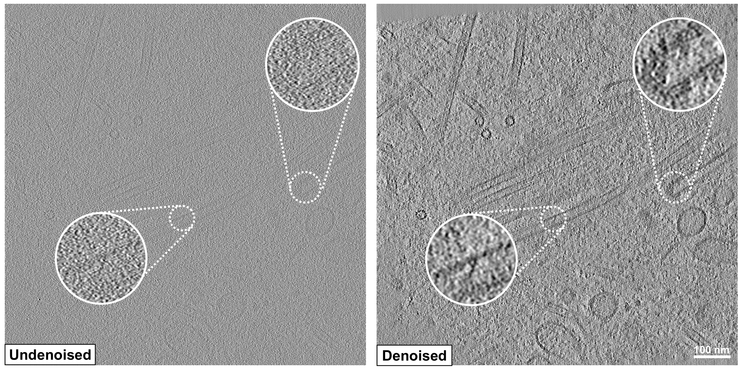 Before and after images showing SNR and resolution improvement after denoising.