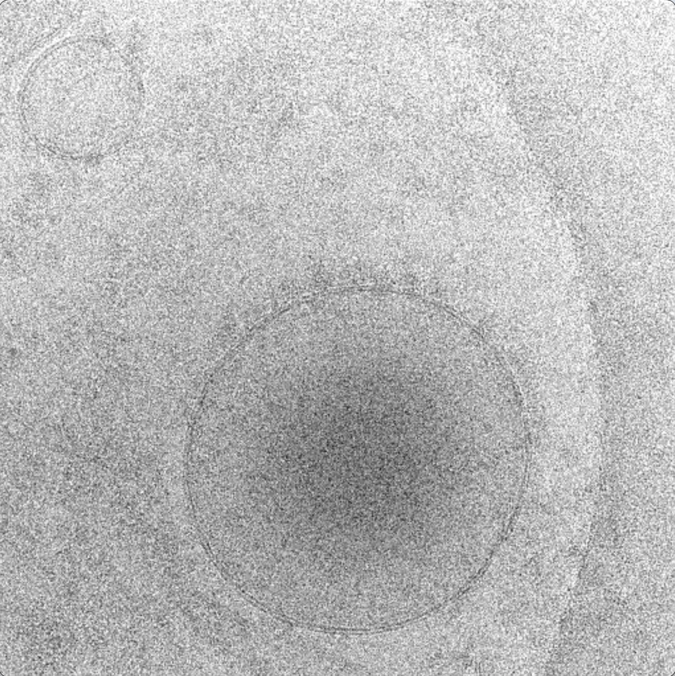 Movie clips of raw tilt series, tilt series after alignment, and tomogram of a purified lysosome.