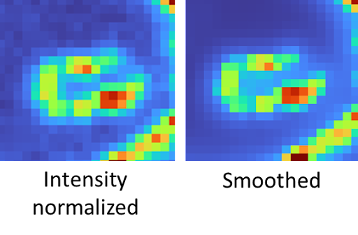 Intensity normalized and smoothed in Allen Cell Segmenter