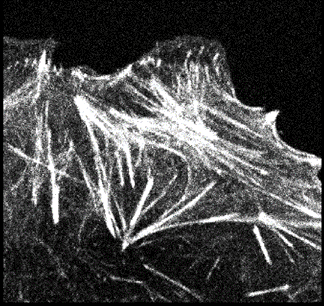 Sample data of actin filaments