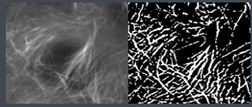 Choosing a comparable image from the Allen Cell Segmenter reference library of images