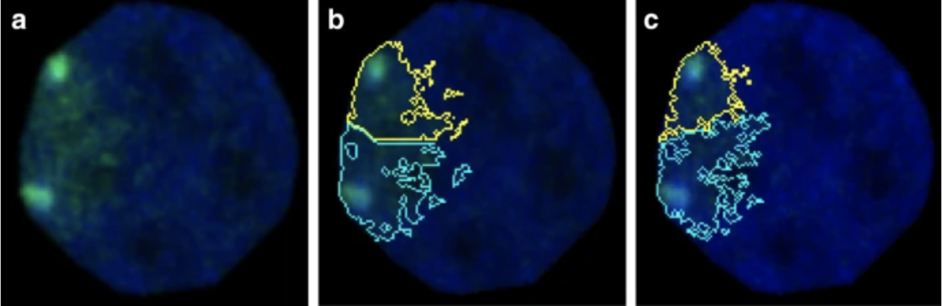 Samples of images segmented by Cellpose